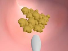 Game Earwax Clinic